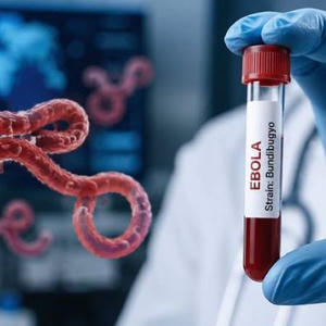 Bộ Y tế cập nhật những dấu hiệu nhận biết bị nhiễm virus Ebola