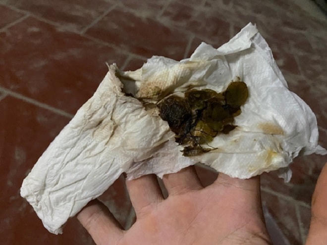 Đi chợ online mùa dịch và cái kết “rớt nước mắt”