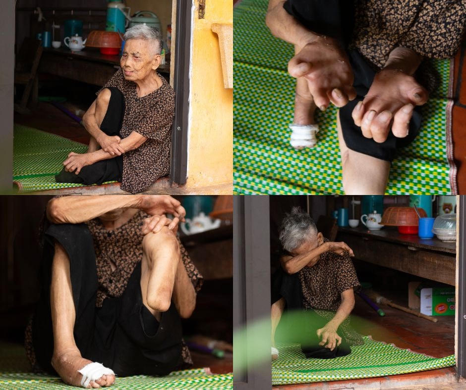 Nghẹn lòng trước số phận những cụ già cả đời sống trong trại phong