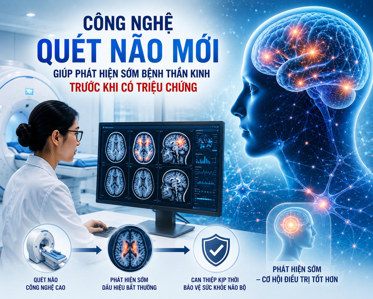 Hình ảnh minh họa.